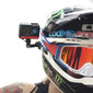 Helm support kit
